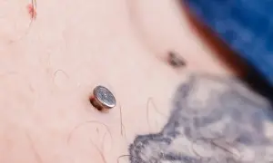 Metalowy kolczyk pod skórą, widoczny na klatce piersiowej obok tatuażu.