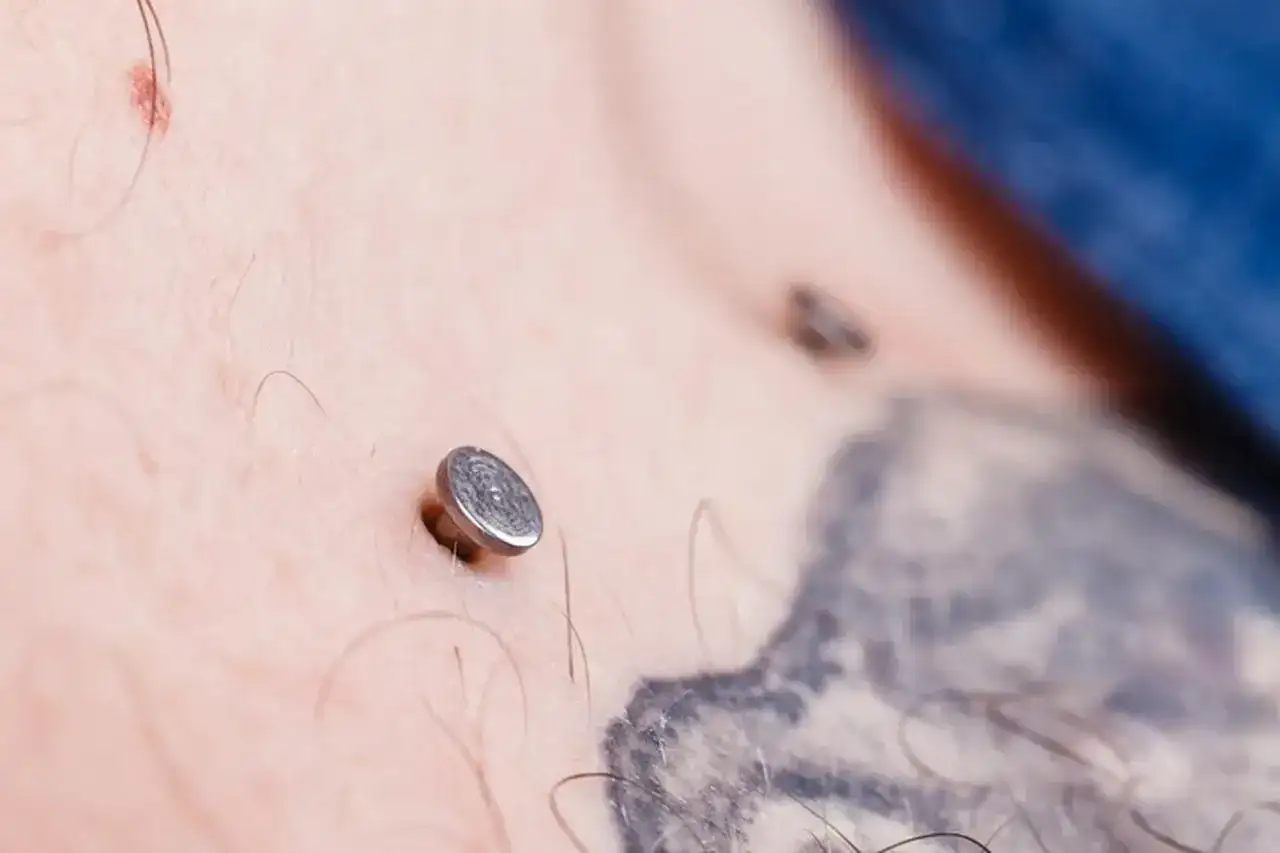 Metalowy kolczyk pod skórą, widoczny na klatce piersiowej obok tatuażu.