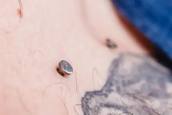 Metalowy kolczyk pod skórą, widoczny na klatce piersiowej obok tatuażu.